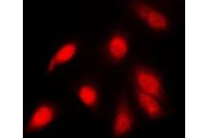 Immunofluorescent analysis of NF-kappaB p65 (pS311) staining in PC12 cells.