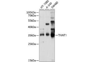 Western blot analysis of extracts of various cell lines, using TNNT1 antibody (ABIN6127683, ABIN6149363, ABIN6149364 and ABIN6214579) at 1:1000 dilution. (TNNT1 抗体  (AA 1-262))