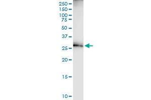 Immunoprecipitation of ECH1 transfected lysate using anti-ECH1 MaxPab rabbit polyclonal antibody and Protein A Magnetic Bead , and immunoblotted with ECH1 purified MaxPab mouse polyclonal antibody (B01P) . (ECH1 抗体  (AA 1-328))
