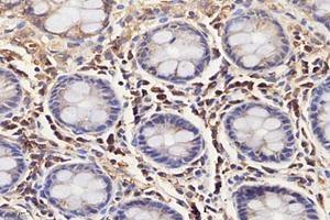 Immunohistochemistry analysis of paraffin-embedded human colon using,IL-3RB (ABIN7073557) at dilution of 1: 4000 (CD131 抗体)