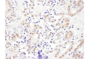 Immunohistochemistry (IHC) image for anti-Exosome Component 10 (EXOSC10) (AA 200-250) antibody (ABIN7454996) (EXOSC10 抗体  (AA 200-250))