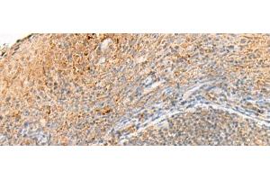Immunohistochemistry of paraffin-embedded Human tonsil tissue using GPR161 Polyclonal Antibody at dilution of 1:40(x200) (GPR161 抗体)