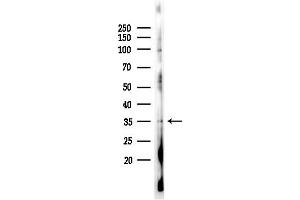 anti-Cysteinyl Leukotriene Receptor 2 (CYSLTR2) (Internal Region) antibody