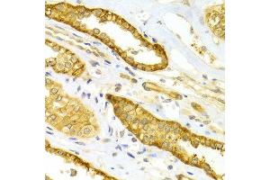 Immunohistochemistry (IHC) image for anti-Selectin E (SELE) (AA 22-230) antibody (ABIN3023172)