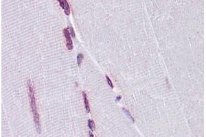 Human Skeletal muscle: Formalin-Fixed, Paraffin-Embedded (FFPE) (EMX2 抗体  (AA 103-201))