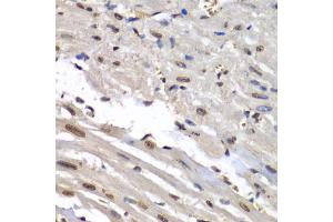 Immunohistochemistry of paraffin-embedded mouse heart using HNRNPM antibody (ABIN5975447) at dilution of 1/100 (40x lens). (HNRNPM 抗体)