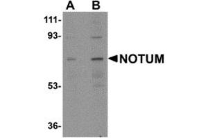 Western Blotting (WB) image for anti-Notum Pectinacetylesterase Homolog (NOTUM) (N-Term) antibody (ABIN1031488) (NOTUM 抗体  (N-Term))