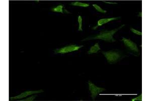 Immunofluorescence of monoclonal antibody to MAPK3 on HeLa cell. (ERK1 抗体  (AA 279-379))