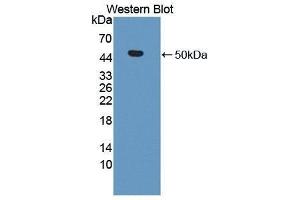 Western Blotting (WB) image for anti-Matrix Metallopeptidase 19 (MMP19) (AA 98-508) antibody (ABIN1869238) (MMP19 抗体  (AA 98-508))