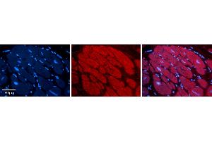 Immunohistochemistry (IHC) image for anti-Nuclear Receptor Subfamily 3, Group C, Member 1 (Glucocorticoid Receptor) (NR3C1) (N-Term) antibody (ABIN2777208)