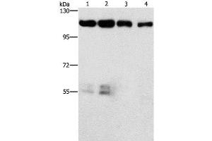 Western Blot analysis of Hela and hepG2 cell, lovo cell and Human colon cancer tissue using CDK11B Polyclonal Antibody at dilution of 1:750 (CDK11 抗体)