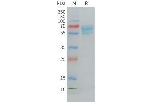 SDS-PAGE (SDS) image for CD7 (CD7) (AA 26-177) protein (Fc Tag) (ABIN7538174)