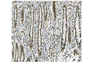 IHC analysis of KAP1/TRIM28 using anti-KAP1/TRIM28 antibody (ABIN7602311).