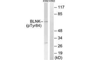 Western blot analysis of extracts from K562 cells treated with starved 24h, using BLNK (Phospho-Tyr84) Antibody. (B-Cell Linker 抗体  (pTyr84))