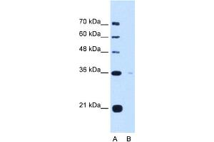 WB Suggested Anti-TOR1B Antibody Titration:  5. (TOR1B 抗体  (C-Term))