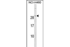RALA Antibody (C-term) (ABIN1536751 and ABIN2850380) western blot analysis in NCI- cell line lysates (35 μg/lane). (rala 抗体  (C-Term))