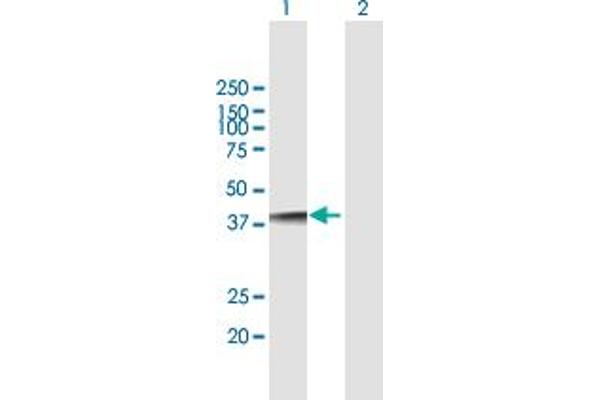 NUDT18 antibody  (AA 1-323)