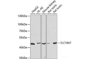 Western blot analysis of extracts of various cell lines using SLC16A7 Polyclonal Antibody at dilution of 1:3000. (SLC16A7 抗体)