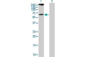 Western Blotting (WB) image for anti-Phosphatidylinositol-5-Phosphate 4-Kinase, Type II, alpha (PIP4K2A) (AA 1-406) antibody (ABIN518909)
