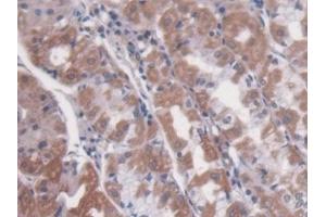 Immunohistochemistry (IHC) image for anti-N-Acetylglucosaminidase, alpha (NAGLU) (AA 485-743) antibody (ABIN7435373)