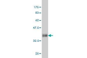 Western Blot detection against Immunogen (36. (PIN1 抗体  (AA 64-163))