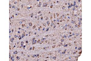 IHC analysis of RPL17 using anti-RPL17 antibody (ABIN7601639). (RPL17 抗体  (AA 40-167))