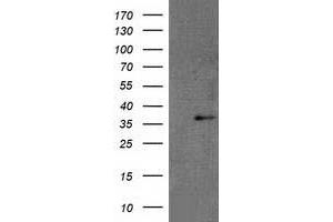 Western Blotting (WB) image for anti-Retinol Dehydrogenase 14 (All-Trans/9-Cis/11-Cis) (RDH14) antibody (ABIN1500655) (RDH14 抗体)