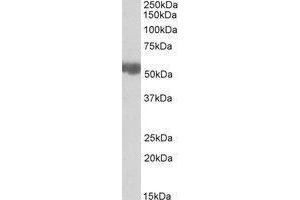 Western blot analysis: ALDH3A2 antibody staining of Rat Liver lysate at 0. (ALDH3A2 抗体  (Internal Region))