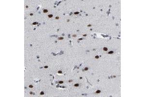 Immunohistochemical staining of human cerebral cortex with FAM180A polyclonal antibody  shows strong nuclear positivity in neuronal cells at 1:20-1:50 dilution. (FAM180A 抗体)