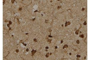 ABIN6276393 at 1/100 staining Human brain tissue by IHC-P. (TCTN3 抗体  (Internal Region))