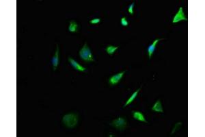 Immunofluorescence staining of SH-SY5Y cells with ABIN7157420 at 1:133, counter-stained with DAPI. (Cytokeratin 2 抗体  (AA 173-283))