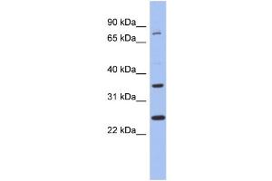 WB Suggested Anti-ZNF133 Antibody Titration:  0. (ZNF133 抗体  (N-Term))