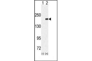 Western blot analysis of EUHMTASE (arrow) using rabbit polyclonal EHMT1 (EUHMTASE1) Antibody (Center) (ABIN387926 and ABIN2844398).