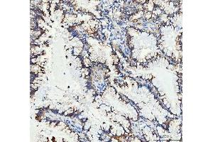 IHC analysis of MUT using anti-MUT antibody (ABIN4886676). (MUT 抗体  (N-Term))