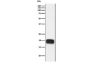 Western blot analysis of Mammaglobin A expression in Human breast cancer lysate.