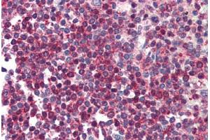 Human Spleen (formalin-fixed, paraffin-embedded) stained with HTRA2 antibody ABIN214496 at 5 ug/ml followed by biotinylated goat anti-rabbit IgG secondary antibody ABIN481713, alkaline phosphatase-streptavidin and chromogen. (HTRA2 抗体  (C-Term))
