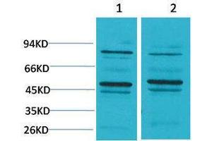Western Blotting (WB) image for anti-Bestrophin 2 (BEST2) antibody (ABIN3181534) (Bestrophin 2 抗体)