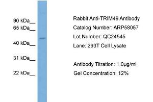 WB Suggested Anti-TRIM49  Antibody Titration: 0. (TRIM49 抗体  (Middle Region))