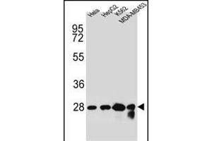 CHPT1 Antibody (N-term) (ABIN654145 and ABIN2844012) western blot analysis in Hela,HepG2,K562,MDA-M cell line lysates (35 μg/lane). (CHPT1 抗体  (N-Term))