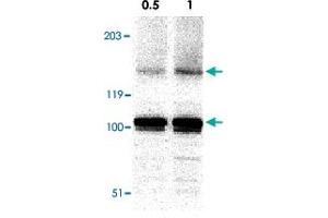 Western blot analysis of IKBKAP in A-20 cell lysate with IKBKAP polyclonal antibody  at in 0. (IKAP/p150 抗体  (C-Term))