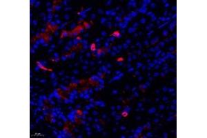 Immunofluorescent analysis of paraformaldehyde-fixed mouse stomach using SYTL2 (ABIN7075797) at dilution of 1: 1200 (SYTL2 抗体)