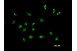 Immunofluorescence of purified MaxPab antibody to XAGE2 on HeLa cell. (XAGE2 抗体  (AA 1-111))