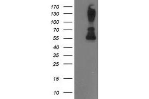 Western Blotting (WB) image for anti-Protein Phosphatase, Mg2+/Mn2+ Dependent, 1B (PPM1B) antibody (ABIN1500374) (PPM1B 抗体)