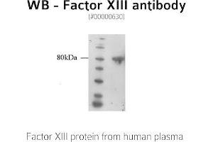 Image no. 1 for anti-Coagulation Factor XIII, A1 Polypeptide (F13A1) antibody (ABIN347012) (F13A1 抗体)