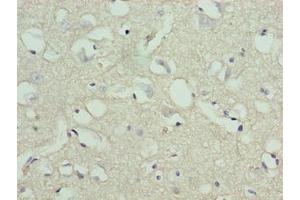 Immunohistochemistry of paraffin-embedded human brain tissue using ABIN7170811 at dilution of 1:100 (STOX1 抗体  (AA 559-858))