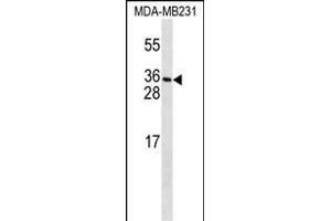PDGFC Antibody (T89) (ABIN650654 and ABIN2837869) western blot analysis in MDA-M cell line lysates (35 μg/lane). (PDGFC 抗体  (N-Term))