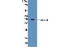 Detection of Recombinant CHRNa4, Human using Polyclonal Antibody to Cholinergic Receptor, Nicotinic, Alpha 4 (CHRNa4) (CHRNA4 抗体  (AA 49-242))