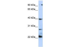 TNFRSF10B antibody (70R-10433) used at 0. (TNFRSF10B 抗体  (N-Term))