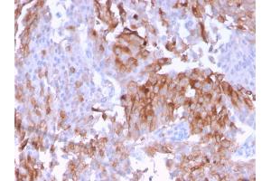 Immunohistochemistry (IHC) image for anti-Uroplakin 1B (UPK1B) (AA 109-229) antibody (ABIN6940858)