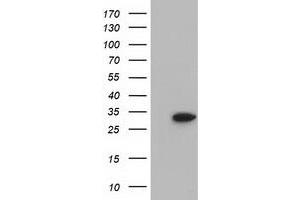 HEK293T cells were transfected with the pCMV6-ENTRY control (Left lane) or pCMV6-ENTRY SULT2A1 (Right lane) cDNA for 48 hrs and lysed. (SULT2A1 抗体)